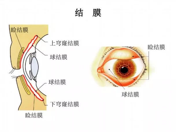 为了保护眼睛,眼球表面覆盖有一层结膜囊,它会在上下眼睑内反折且与